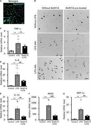 Direct Inhibition of Microglia Activation by Pretreatment With Botulinum Neurotoxin A for the Prevention of Neuropathic Pain